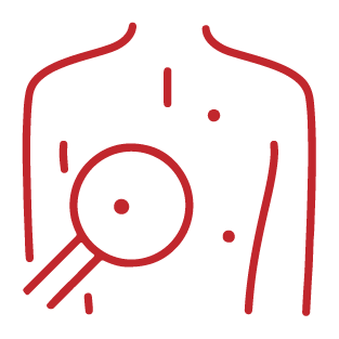 back mole Icon